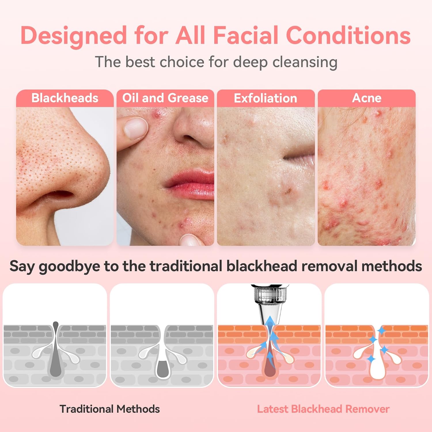 Electric Black Head Suction Instrument Face Cleaner